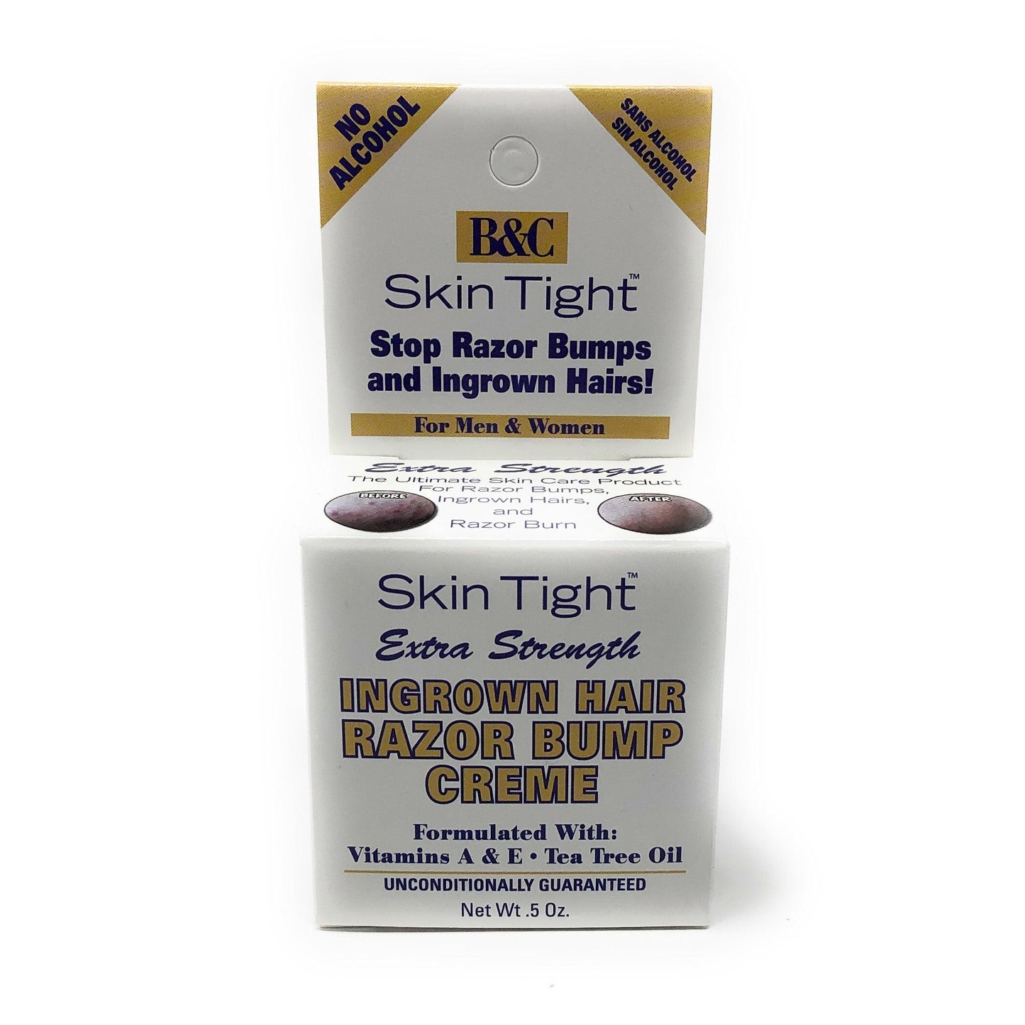 Skin Tight Extra Strength Ingrown Hair Razor Bump Creme (.5oz)